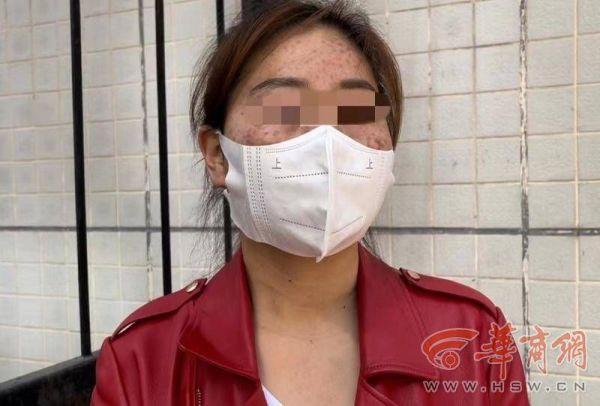 科普问答:关于毁容女孩被造谣不退彩礼遭泼硫酸的思考